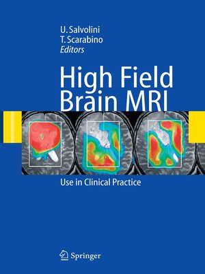 cover image of High Field Brain MRI